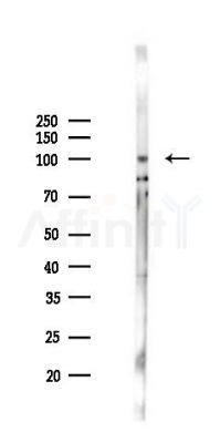 IGF1 Receptor Antibody - Western blot analysis of lysates from A2780 cells(LPS 4h treatment), using IGF1 Receptor Antibody at 1/1000 dilution.