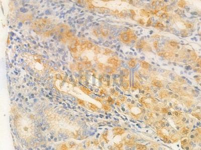 Src Antibody - AF6161 at 1/100 staining human normal gastric tissue by IHC-P.