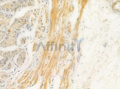 Ezrin Antibody - AF6172 at 1/100 staining human normal gastric tissue by IHC-P.