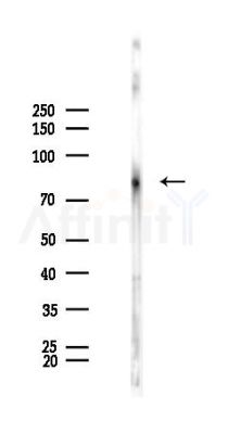PKC alpha Antibody - Western blot analysis of lysates from Rat brain, using PKC alpha Antibody at 1/1000 dilution.