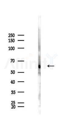 VEGFR1 Antibody - Western blot analysis of lysates from Rat brain, using VEGFR1 Antibody at 1/1000 dilution.
