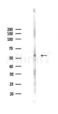 VEGFR1 Antibody - Western blot analysis of lysates from A2780 cells(LPS 4h treatment), using VEGFR1 Antibody at 1/1000 dilution.