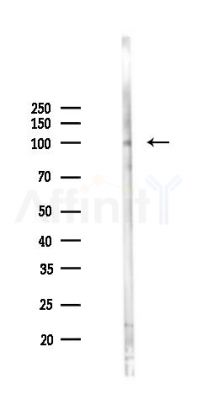 NF kappaB p105/p50 Antibody - Western blot analysis of lysates from A2780 cells(LPS 4h treatment), using NF kappaB p105/p50 Antibody at 1/1000 dilution.