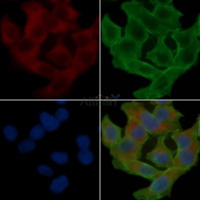 Synaptotagmin 1/2 Antibody - AF6224 staining Hela cells(24h of starvation treatment) by IF/ICC.