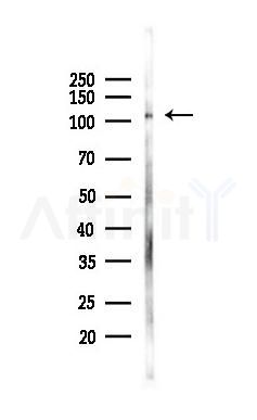 ADD1 Antibody - Western blot analysis of lysates from K562 cells(UV 30min treatment), using ADD1 Antibody at 1/1000 dilution.