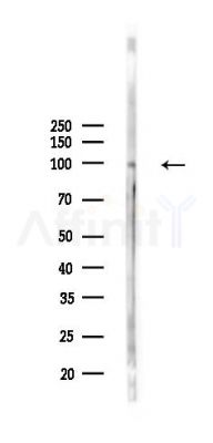STAT6 Antibody - Western blot analysis of lysates from A2780 cells(LPS 4h treatment), using STAT6 Antibody at 1/1000 dilution.