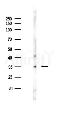 Caspase 3 Antibody - Western blot analysis of lysates from HUVEC cells(LPS 4h treatment), using Caspase 3 Antibody at 1/1000 dilution.