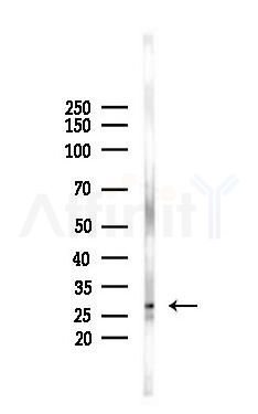 p27 Kip1 Antibody - Western blot analysis of lysates from Rat lung, using p27 Kip1 Antibody at 1/1000 dilution.