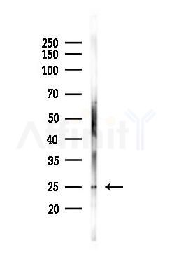 p27 Kip1 Antibody - Western blot analysis of lysates from K562 cells(UV 30min treatment), using p27 Kip1 Antibody at 1/1000 dilution.
