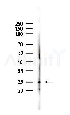 p27 Kip1 Antibody - Western blot analysis of lysates from RAW264.