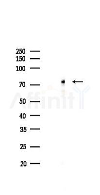 YAP Antibody - Western blot analysis of lysates from A2780 cells(LPS 4h treatment), using YAP Antibody at 1/1000 dilution.