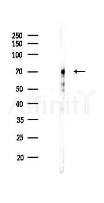 YAP Antibody - Western blot analysis of lysates from HUVEC cells(LPS 4h treatment), using YAP Antibody at 1/1000 dilution.