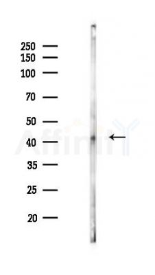 VASP Antibody - Western blot analysis of lysates from HUVEC cells(LPS 4h treatment), using VASP Antibody at 1/1000 dilution.