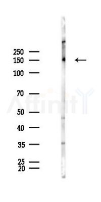 HDAC4 Antibody - Western blot analysis of lysates from Rat brain, using HDAC4 Antibody at 1/1000 dilution.