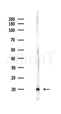 Histone H3 Antibody - Western blot analysis of lysates from HUVEC cells(LPS 4h treatment), using Histone H3 Antibody at 1/1000 dilution.