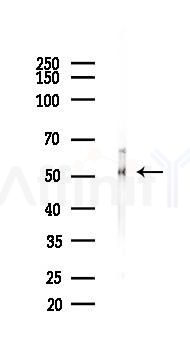 NF kappaB p100/p52 Antibody - Western blot analysis of lysates from Mouse lung, using NF kappaB p100/p52 Antibody at 1/1000 dilution.