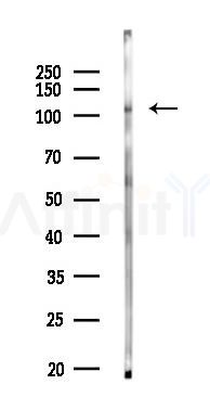 FAK Antibody - Western blot analysis of lysates from HUVEC cells(LPS 4h treatment), using FAK Antibody at 1/1000 dilution.