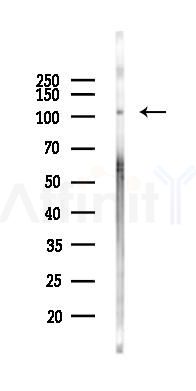 FAK Antibody - Western blot analysis of lysates from EC304 cells(heat-shock 45min treatment), using FAK Antibody at 1/1000 dilution.