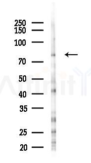 PKC delta Antibody - Western blot analysis of lysates from EC304 cells(starvation 24h treatment), using PKC delta Antibody at 1/1000 dilution.