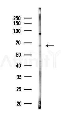 HDAC1 Antibody - Western blot analysis of lysates from HUVEC cells(LPS 4h treatment), using HDAC1 Antibody at 1/1000 dilution.