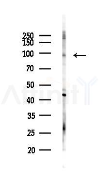 Trk B Antibody - Western blot analysis of lysates from EC304 cells(heat-shock 45min treatment), using TrkB Antibody at 1/1000 dilution.