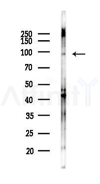 Trk B Antibody - Western blot analysis of lysates from EC304 cells(heat-shock 45min treatment), using TrkB Antibody at 1/1000 dilution.
