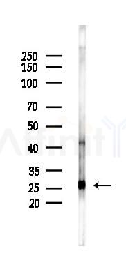 BAD Antibody - Western blot analysis of lysates from Rat liver, using BAD Antibody at 1/1000 dilution.