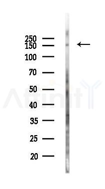 ASK1 Antibody - Western blot analysis of lysates from EC304 cells(heat-shock 45min treatment), using ASK1 Antibody at 1/1000 dilution.
