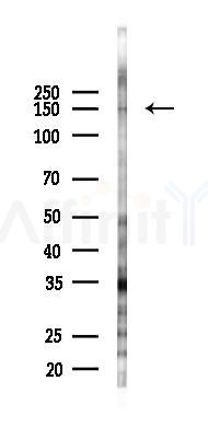 HDAC6 Antibody - Western blot analysis of lysates from EC304 cells(starvation 24h treatment), using HDAC6 Antibody at 1/1000 dilution.