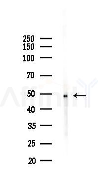 Parkin Antibody - Western blot analysis of lysates from Rat liver, using Parkin Antibody at 1/1000 dilution.