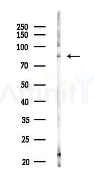 DNMT3A Antibody - Western blot analysis of lysates from HUVEC cells(LPS 4h treatment), using DNMT3A Antibody at 1/1000 dilution.