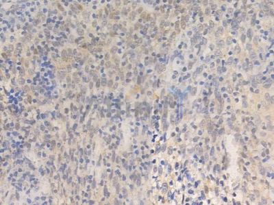 TMS1/ASC Antibody - AF6515 at 1/100 staining human normal tonsil tissue by IHC-P.