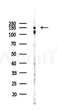 ZO-2 Antibody - Western blot analysis of lysates from EC304 cells(heat-shock 45min treatment), using ZO-2 Antibody at 1/1000 dilution.