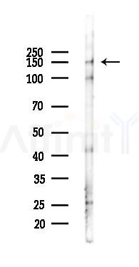 ZO-2 Antibody - Western blot analysis of lysates from Mouse lung, using ZO-2 Antibody at 1/1000 dilution.