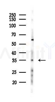 SIRT6 Antibody - Western blot analysis of lysates from HUVEC cells(starvation 24h treatment), using SIRT6 Antibody at 1/1000 dilution.