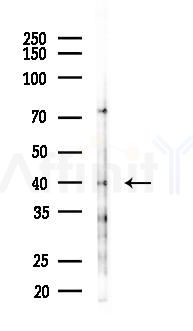 SIRT6 Antibody - Western blot analysis of lysates from EC304 cells(starvation 24h treatment), using SIRT6 Antibody at 1/1000 dilution.