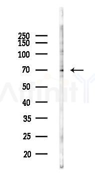 RIPK1 Antibody - Western blot analysis of lysates from EC304 cells(heat-shock 45min treatment), using RIPK1 Antibody at 1/1000 dilution.