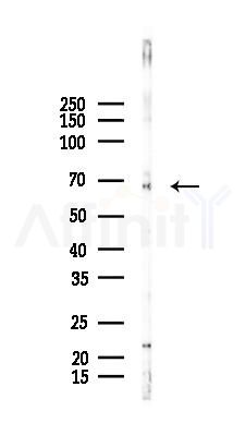 MEF2C Antibody - Western blot analysis of lysates from EC304 cells(heat-shock 45min treatment), using MEF2C Antibody at 1/1000 dilution.