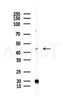IRF9 Antibody - Western blot analysis of lysates from EC304 cells(heat-shock 45min treatment), using IRF9 Antibody at 1/1000 dilution.
