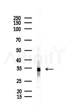 Casein Kinase 1 alpha Antibody - Western blot analysis of lysates from EC304 cells(heat-shock 45min treatment), using Casein Kinase 1 alpha Antibody at 1/1000 dilution.