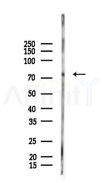 YAP Antibody - Western blot analysis of lysates from EC304 cells(heat-shock 45min treatment), using YAP Antibody at 1/1000 dilution.