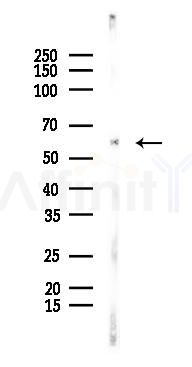 CD50/ICAM-3 Antibody - Western blot analysis of lysates from EC304 cells(heat-shock 45min treatment), using CD50/ICAM-3 Antibody at 1/1000 dilution.