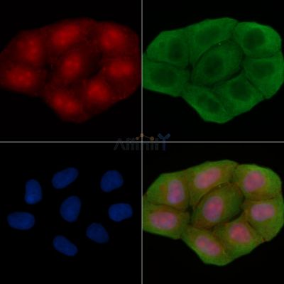 Nucleophosmin Antibody - AF6740 staining Hela cells(30min of UV treatment) by IF/ICC.