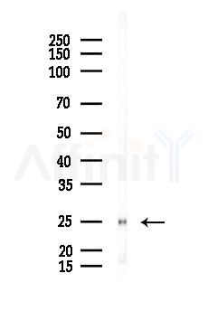 eIF4E Antibody - Western blot analysis of lysates from EC304 cells(heat-shock 45min treatment), using eIF4E Antibody at 1/1000 dilution.