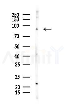 Progesterone Receptor Antibody - Western blot analysis of lysates from EC304 cells(heat-shock 45min treatment), using Progesterone Receptor Antibody at 1/1000 dilution.