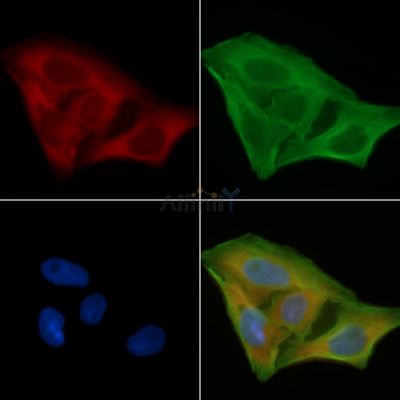 SOD2/MnSOD Antibody - AF6751 staining Hela cells(30min of UV treatment) by IF/ICC.
