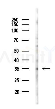 SNAIL Antibody - Western blot analysis of lysates from Rat brain, using SNAIL Antibody at 1/1000 dilution.