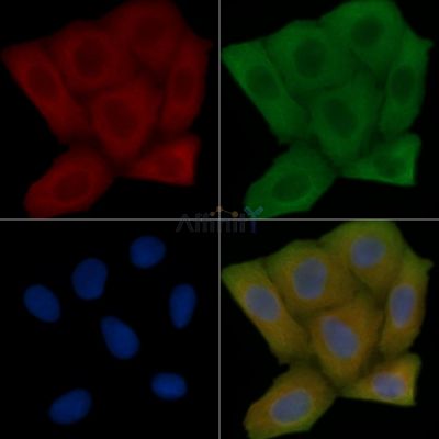 Mitofusin 2 Antibody - AF6760 staining Hela cells(30min of UV treatment) by IF/ICC.