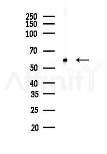 SMAD6 Antibody - Western blot analysis of lysates from Mouse brain, using SMAD6 Antibody at 1/1000 dilution.