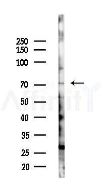 FOXO3A Antibody - Western blot analysis of lysates from 293 cells(starvation 24h treatment), using FOXO3A Antibody at 1/1000 dilution.